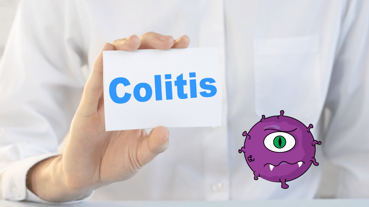 Infectious Colitis Causes, Symptoms, and Treatment